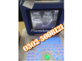 japnease-ultrasound-machine-available-in-stock-small-0