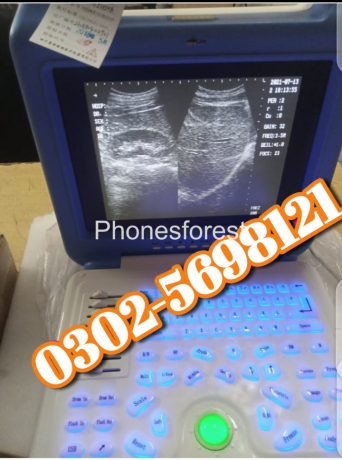 japnease-ultrasound-machine-available-in-stock-big-0