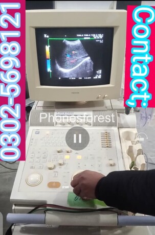 japanese-ultrasound-machine-big-1