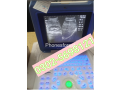 orial-plus-ultrasound-machine-small-2